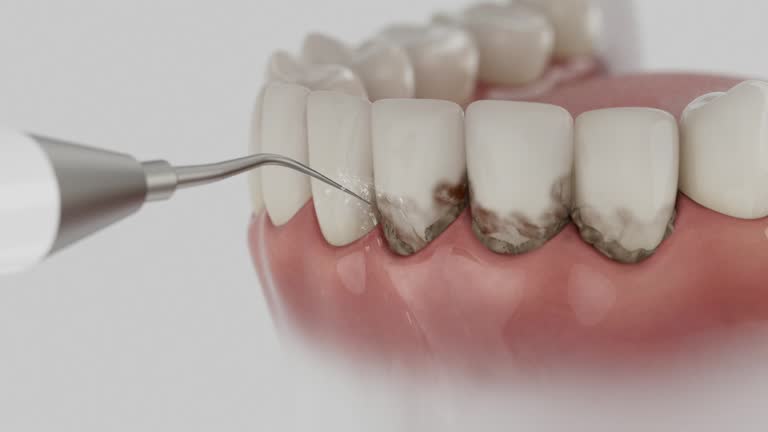 Trusted Teeth Cleaning And Checkup service in St. Augustine South, FL - Dentist Open Now